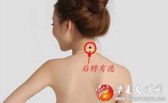 “背有痣，穷一生”说法准吗？