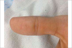 手相算命凤眼纹不封闭穷一辈子是真的吗？