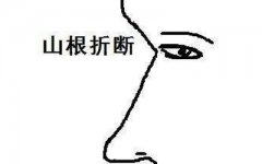 震惊！面相算命山根断的人竟是这样的！