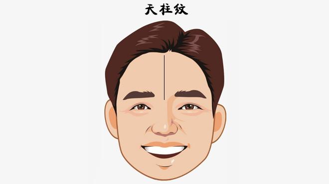 额头纵纹
