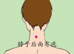 面相看财运_解析苦情痣的人命运怎样？