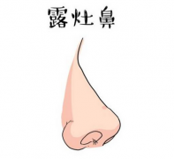 看相算命图解_三种鼻子一生少富贵_希望没有你！[图解]