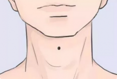 相面算命_四个绝佳的财富痣有一颗一辈子能大富大贵！`