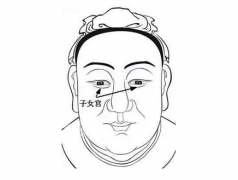 一定要点掉的几颗痣_快来看看