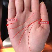 看相算命_大师分析婚姻线上有岛纹的人婚姻生活如何（爱情）
