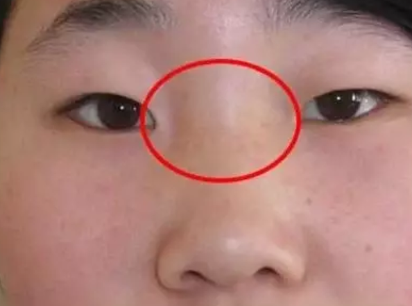 1598795278622411.png blob.png