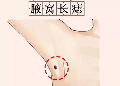 在痣相书上有记载,腋下长痣的人际关系好,异性缘强,主钱财逼身,代表的