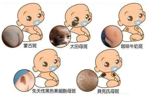 1656087360922558.png 1656084337(1).png