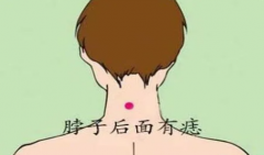 女人脖子右长痣富贵 痣相算命有贵人相助能幸福