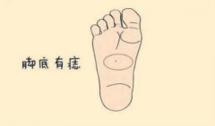 女人脚底长痣富贵吗 痣相算命脚掌有痣之人给予极高称许