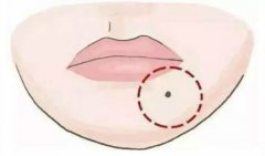 嘴巴周围有痣代表什么?痣相算命有痣为积蓄会日益减少