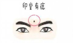 <b>眉毛中间有痣好不好?痣相算命</b>