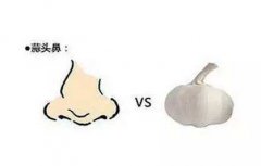 什么是蒜头鼻，蒜头鼻面相怎么样？