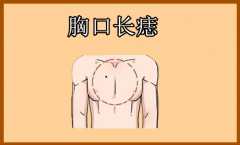 胸前有颗痣的女人是有桃花劫吗 痣相算命不缺富贵福泽深厚